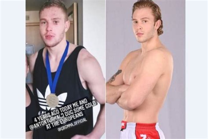 Anton Turkalj Wikipedia – Who Is He? Parents Ethnicity And Age