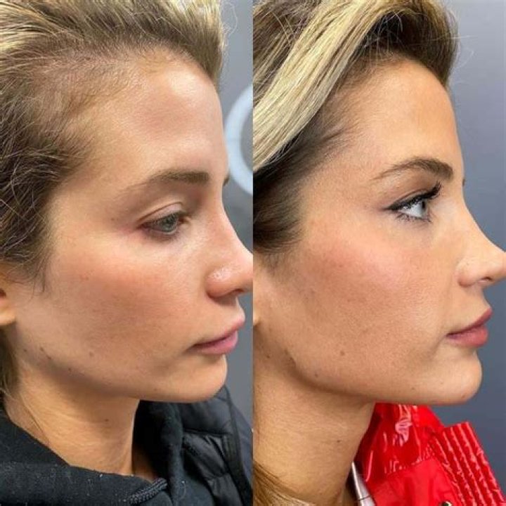 Southern Charm’s Naomie Olindo got a new nose: ‘Plastic surgery shouldn’t be taboo’