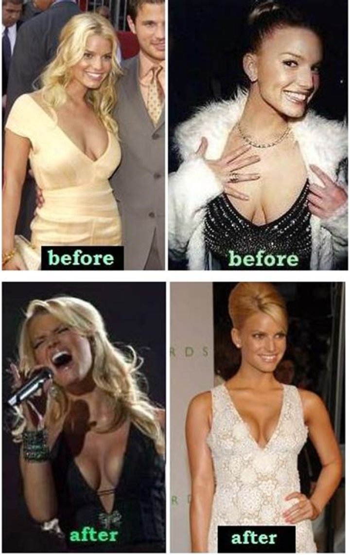 Us Weekly: Jaime Pressly probably got a boob job