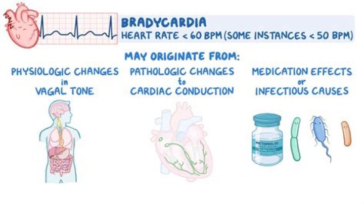 Why does hypothermia cause bradycardia?